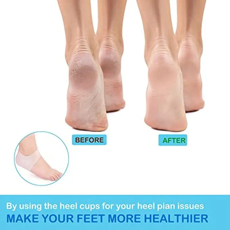 Nature's Shoewear™ Gel Silicone Heel Protector Cups Sleeves for Feet