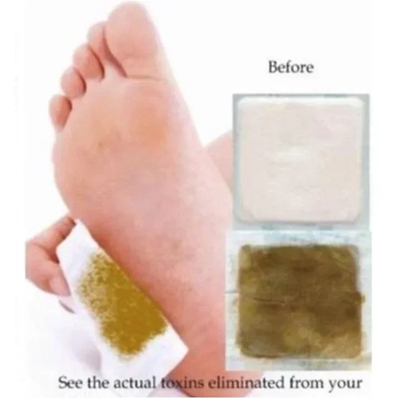 Nature's Shoewear™ Kinoki Cleansing Detox Leg Herbal Pads