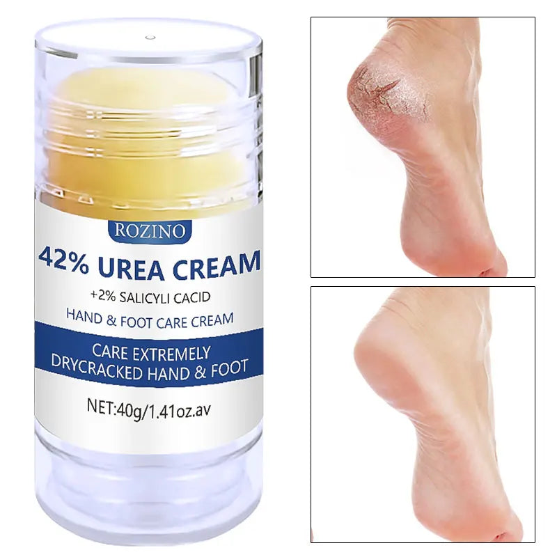 Nature's Shoewear™ 1.41oz 42% Urea Foot and Hand Care Cream Stick