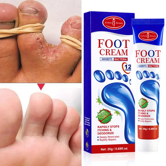 Nature's Shoewear™ Herbal Foot Fungus Removal Cream